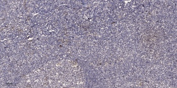 CtBP2 rabbit pAb