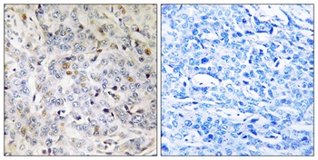 PDIK1L antibody