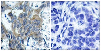 Catenin-β (phospho Ser33) rabbit pAb