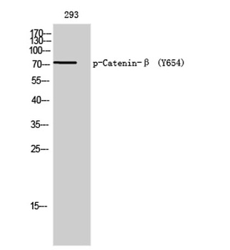 Catenin-β (phospho Tyr654) rabbit pAb Antibody