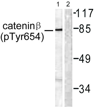 Catenin-β (phospho Tyr654) rabbit pAb