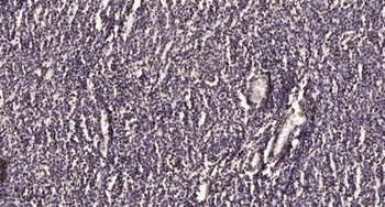 Catenin-β (phospho Tyr654) rabbit pAb