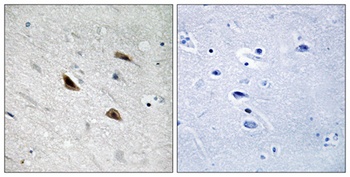 Catenin-beta (phospho-Tyr489) antibody