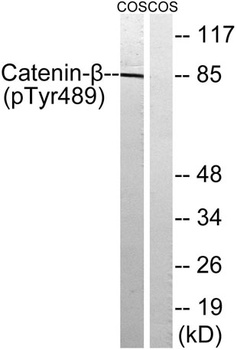 Catenin-beta (phospho-Tyr489) antibody