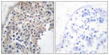 AR α2A rabbit pAb