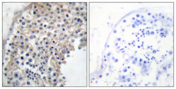 AR alpha 2A antibody