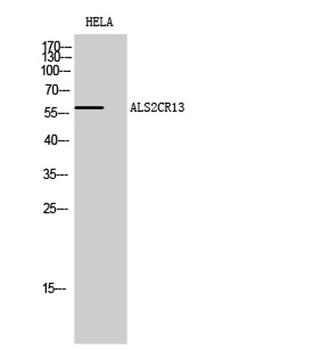 ALS2CR13 rabbit pAb Antibody