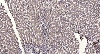 Cathepsin D rabbit pAb