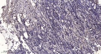 PP2C Epsilon antibody