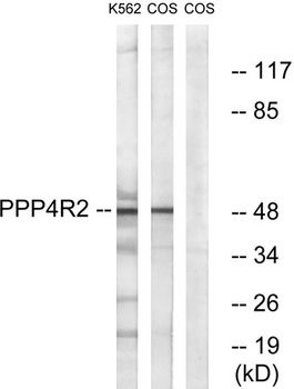 PP4R2 rabbit pAb