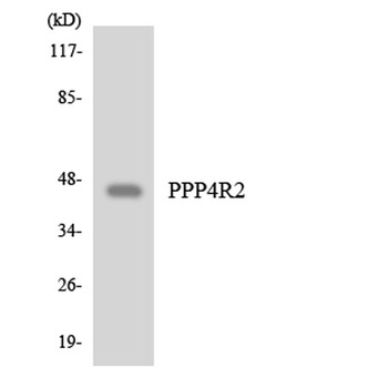PP4R2 rabbit pAb