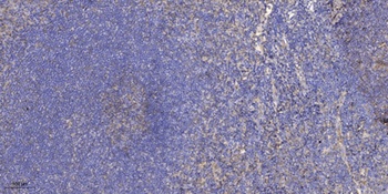 PP4R2 antibody