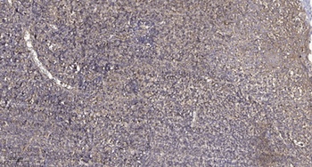 PPP1R2P3 rabbit pAb Antibody