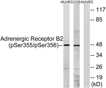 AR-β2 (phospho Ser355/S356) rabbit pAb