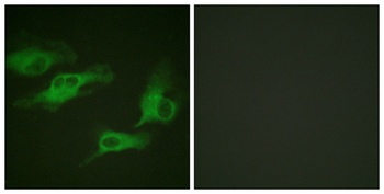 AR-β2 (phospho Ser346) rabbit pAb