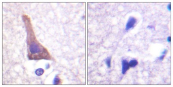 AR-β2 (phospho Ser346) rabbit pAb