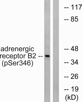 AR-β2 (phospho Ser346) rabbit pAb