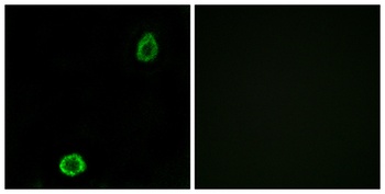 ABCA13 rabbit pAb Antibody