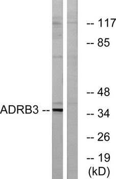 AR-beta 3 antibody