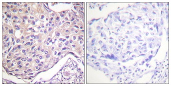 GRK 2 (phospho Ser29) rabbit pAb