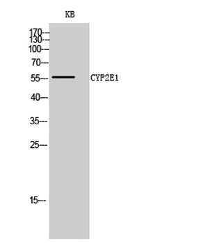 CYP2E1 rabbit pAb