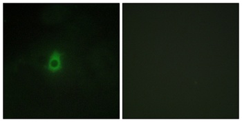 CYP2E1 rabbit pAb