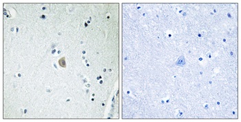 CYP2E1 rabbit pAb