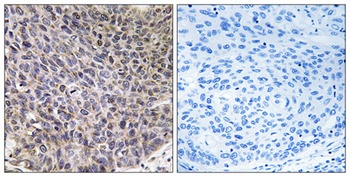 CYP4B1 antibody