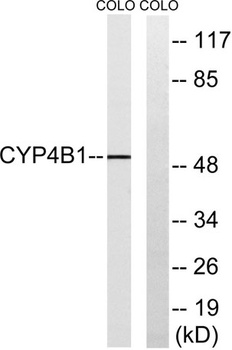 CYP4B1 rabbit pAb