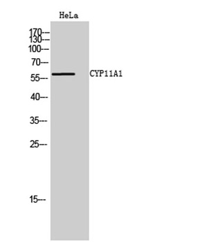 CYP11A1 rabbit pAb Antibody