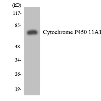 CYP11A1 rabbit pAb