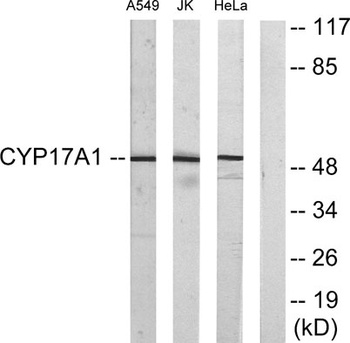 CYP17A1 rabbit pAb