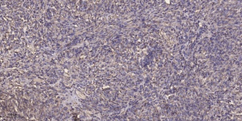CYP17A1 rabbit pAb