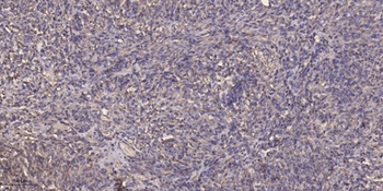 CYP17A1 antibody