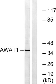 DGAT2L3 antibody