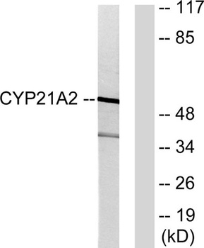 CYP21A2 rabbit pAb