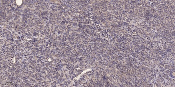 CYP21A2 rabbit pAb