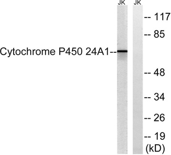 CYP24A1 rabbit pAb