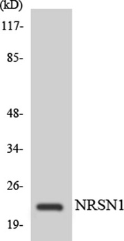 CYP24A1 antibody