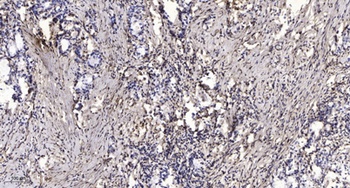 CYP24A1 rabbit pAb