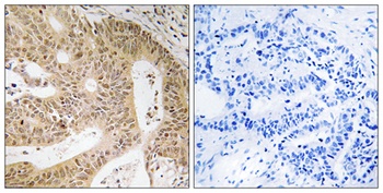 DAP-1 rabbit pAb Antibody