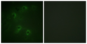 DAPK1 antibody