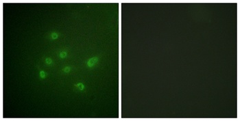 DAPK3 (phospho Thr265) rabbit pAb