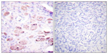Daxx (phospho Ser668) rabbit pAb