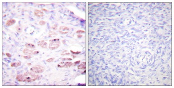 Daxx (phospho-Ser668) antibody