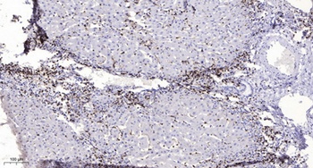 mPR alpha antibody