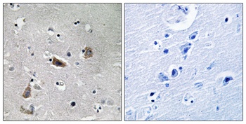 Doublecortin (phospho Ser339) rabbit pAb