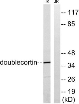 Doublecortin rabbit pAb