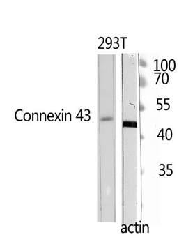 Doublecortin antibody