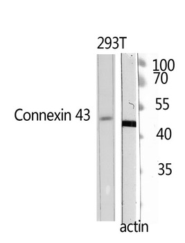 Doublecortin rabbit pAb